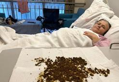 Manisa'da tıp tarihine geçecek ameliyat: Çıkan taşları sayamayınca yapay zeka tespiti yaptı!