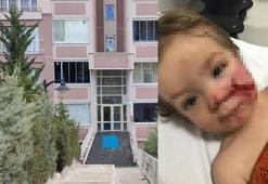 Ankara'da 2 çocuğu yaralayan pitbull cinsi köpeğin sahibi tutuklandı