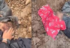 10 yaşındaki çocuk kayıp olarak aranıyordu! Yaralı ve vücudunun bir kısmı toprağa gömülü bulundu