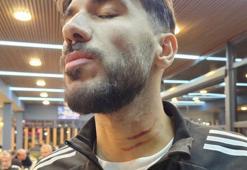 Mazıdağı Fosfat Spor Kulübü'nden hakemlere tepki