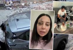 Boşanma aşamasındaki eşine şiddet uygulayan şahsın ifadesi ortaya çıktı: Burun estetiği masrafını karşıladım boşanmak istedi