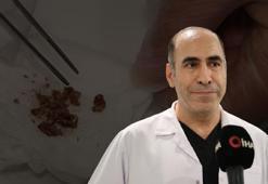 Elazığ’da ameliyat oldu, burnundan çıkanlar şoke etti