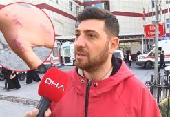 Kedisi tarafından ısırılan vatandaş antibiyotik verilerek gönderildi! Enfeksiyon kapan parmağı kopma noktasına geldi