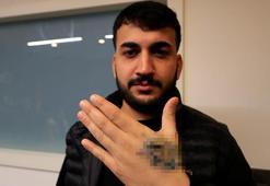 Dövme sildirmek isterken hayatı kâbusa döndü! Güzellik merkezinden aldığı cevapla ikinci şoku yaşadı