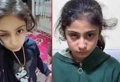 Plastik diye sattıkları gözlük cam çıktı! Şeyma bir gözünü kaybetti