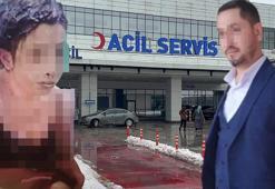 Gaziantep'te eski koca vahşeti! Genç kadını bağlayıp başına kezzap döktü