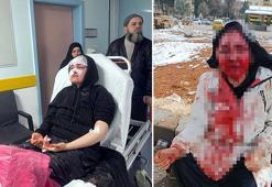 Gaziantep'te korkunç olay! Boşanma aşamasındaki eşine kaldırım taşıyla işkence etti