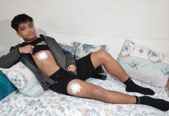 Akran zorbalığı az kalsın öldürüyordu! Önce dövüldü sonra bıçaklandı