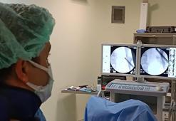 Sağlık çalışanları bile inanamadı! Daha önce 21 kez ameliyat oldu böbreğinden tam 295 taş çıktı!