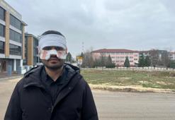 Eskişehir'de okulda dehşet! Öğretmen arkadaşını feci şekilde yaktı