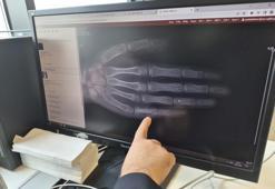 Eskişehir'de her ay 5 ila 7 çocuğun başına geliyor! Aileler buna dikkat