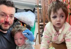 Gürültü tartışmasında komşusu dehşet saçtı! 14 aylık bebeğe bile acımadı