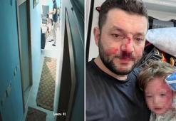 Baba ile 14 aylık bebeğini darbetmişlerdi! Gözü dönmüş şüphelilerin ifadesi ortaya çıktı