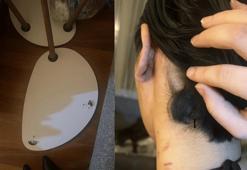 Eskişehir'de eski sevgilisi kulağını ısırdı! İşte nedeni