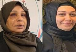 Ankara'da eşine işkence yapan polis memurunun dosyası, ağır cezaya gönderildi