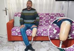 700 TL alacağı için verdiği IBAN hayatını kararttı! Protez bacaklı vatandaşa hapis cezası verdildi