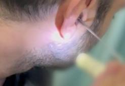 Kayseri’de bir kişi kulağına gizlediği uyuşturucuyla yakalandı