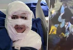 Kadıköy'de kolonya döküp kadını ateşe vermişti! İlk defa hakim karşısına çıktı: 'Saçlarını yakma isteği doğdu'