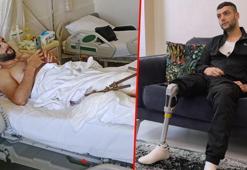 Motosiklet kazasında bacağını kaybetti! Bursalı hayırseverler yardımına koştu: Artık yürüyebilecek