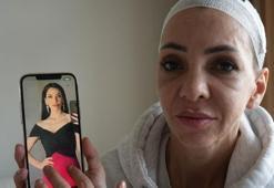 Bayramda 'küfretmeyin' diye uyaran anne ve oğlunu feci şekilde darp etmişlerdi; Meryem Yıldırım yaşadığı dehşeti unutamıyor