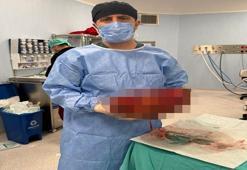 Karın ağrısı şikayetiyle hastaneye gitti! Doktorlar bile gözlerine inanamadı: Tam 8 kilo