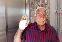 Hatay'da akılalmaz olay! Asansörde 70 yaşındaki komşusunun parmağını ısırarak kopardı