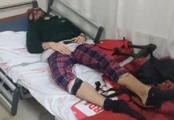 Yılan otu Türk Örümcek Adam'ı hastanelik etti