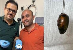 Alaşehir'de ağrı ve işitme kaybı nedeniyle hastaneye gitti, kulağından Japon böceği çıktı