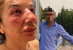 Yardıma çağırdığı kadını kemerle boğmaya çalıştı: İzmir'de korku dolu anlar
