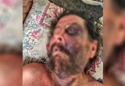 İzmir'de akıl almaz vahşet! 'Abimin cenazesine neden gelmedin?' diyerek öldüresiye dövdü, sonra ölüme terk etti!