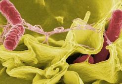 Salmonella salgını: İngiltere'de 1 kişi öldü, 207 vaka tespit edildi
