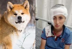 İzmir'de köpek saldırısı davasında karar verildi! Yüzünde kalıcı izler oluşan çocuğa rekor tazminat