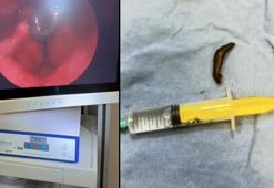 Doktorlar bile şaşkına döndü! Çeşmeden su içti, boğazından canlı canlı çıktı