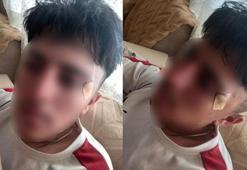 Eğitim merkezinde öğretmenin kafa attığı çocuğun burnu kırıldı