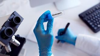 DSÖ'den maymun çiçeği uyarısı: Acil durumu ilan edildi