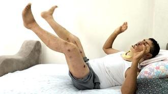 Manavgat'ta aslan saldırısına uğrayan çiftçi açıklama yaptı: 'Bu olayda tek suçsuz olan ben ve aslan'