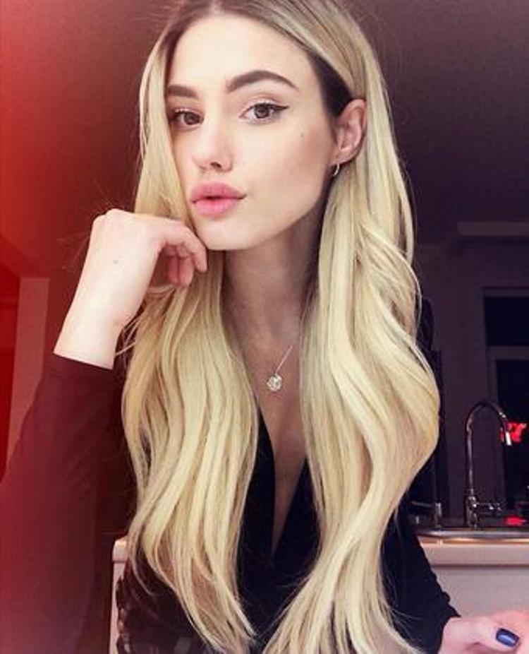 Bacağını kesmeliyiz denilen ünlü model mesleğine dönüyor