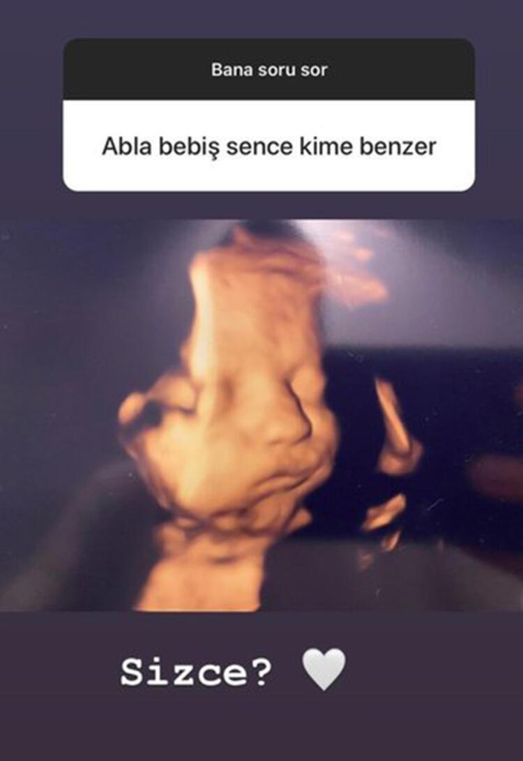 Çocuklar Duymasının Duygusu Ayşecan Tatari bebek için gün sayıyor