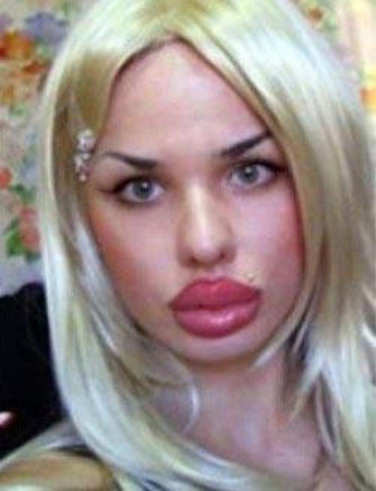 Губы муклы. Девушки с силиконом. Огромные перекаченные губы. Фото силиконовые женщины. Тиана джуричич.