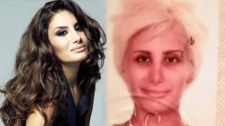 Ünlülerin estetiksiz hali