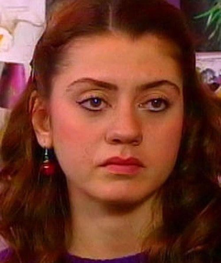 Ünlülerin estetiksiz hali