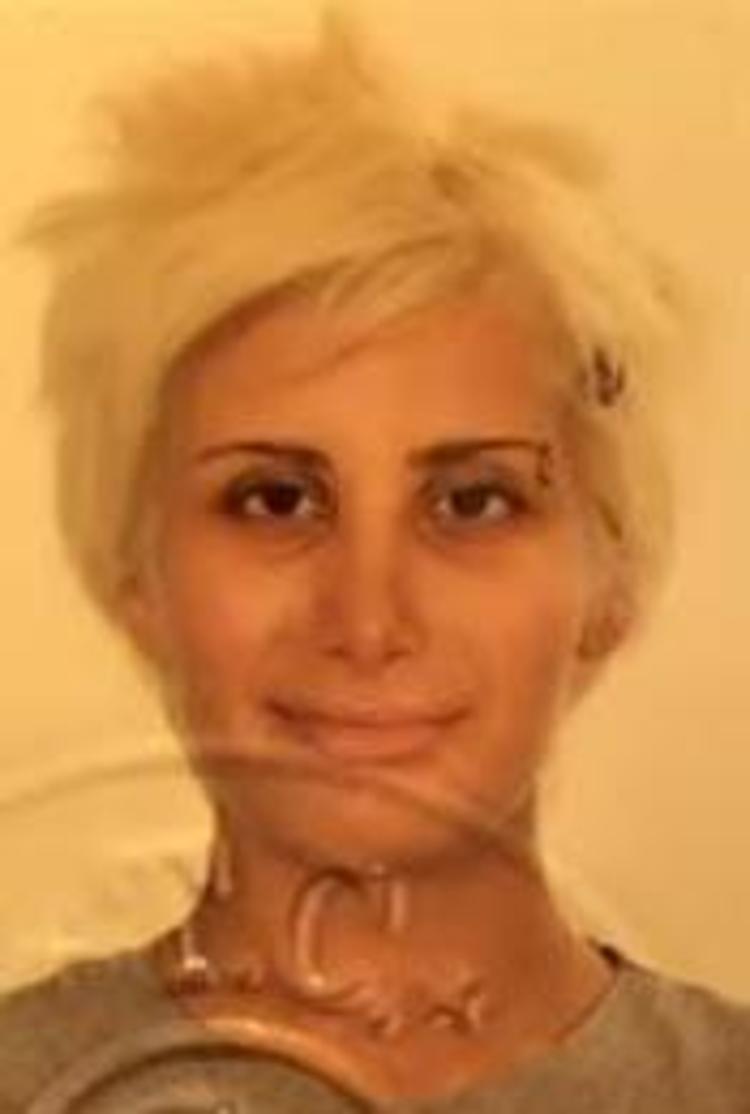 Zeynep Koçak bambaşka biri oldu Görenler tanıyamıyor