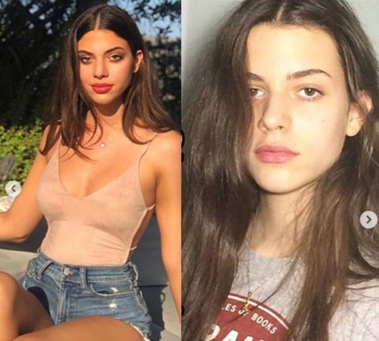 Zeynep Koçak bambaşka biri oldu Görenler tanıyamıyor