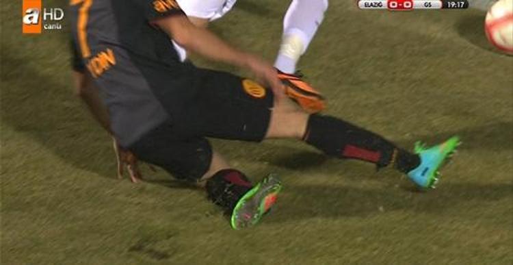 Ayağı kırılan futbolcular