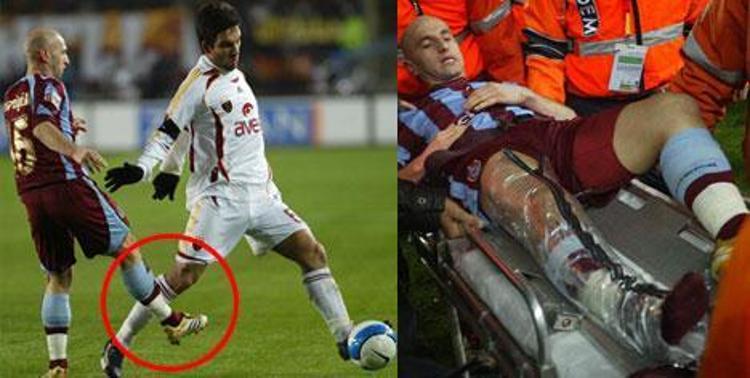 Ayağı kırılan futbolcular