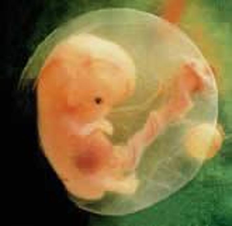 Как выглядит малыш на 11 неделе беременности. Эмбрион в жидкости. Эмбрион в жидкости. Эмбрион в жидкости. Водянка плодных оболочек у животных.