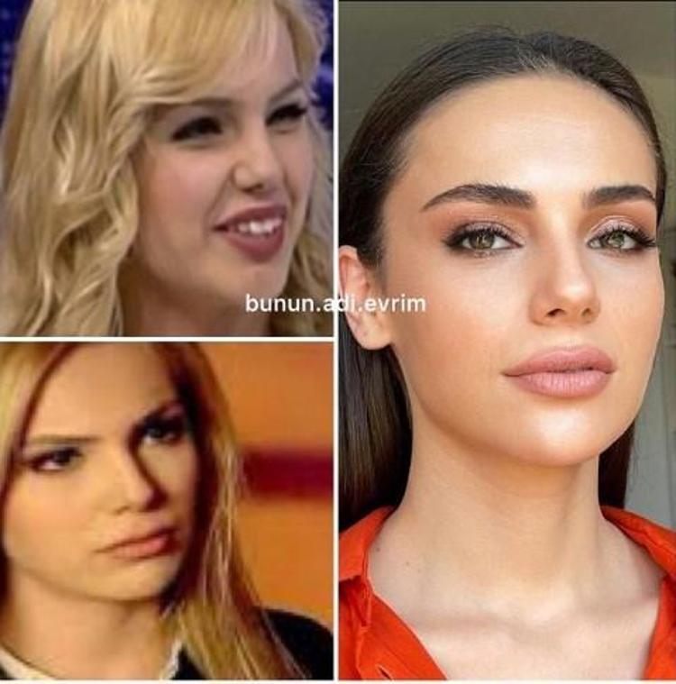 Zeynep Koçak bambaşka biri oldu Görenler tanıyamıyor