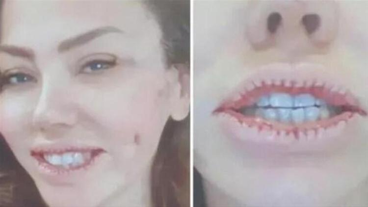 Estetikli ünlüler kervanına katılan Mahmut Tuncer: Ivana geleceği görmüş