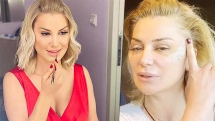 Estetikli ünlüler kervanına katılan Mahmut Tuncer: Ivana geleceği görmüş