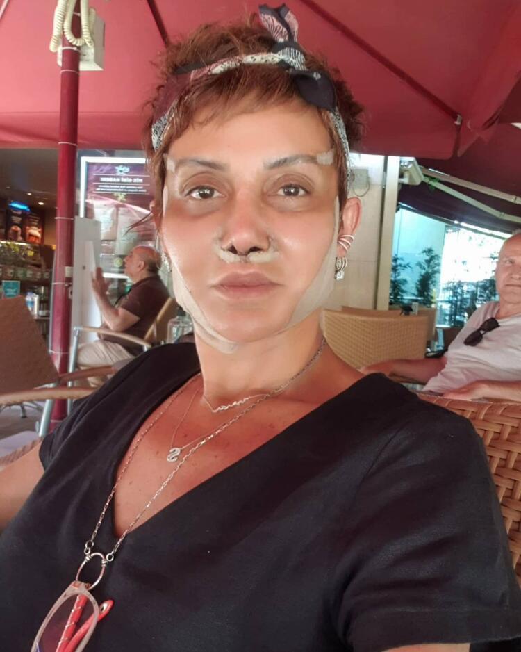 İrem Dericiden estetik yanıtı